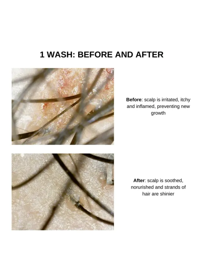 Luxury Rosemary Conditioner 300Ml – image 5