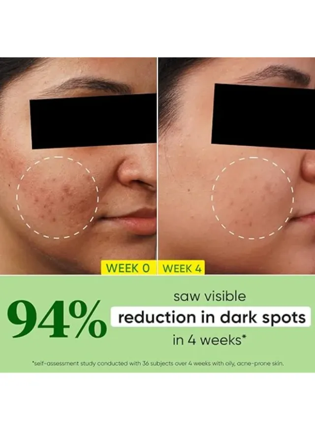 Dot & Key 10% Niacinamide + Strawberry Face Serum Bright Pink – image 5