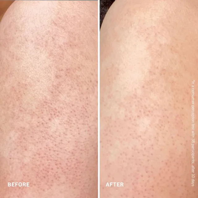 10% AHA Body Scrub with Pumice for KP Bumps and Sensitive Skin – image 2