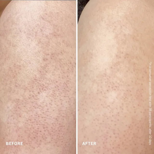KP Smoothing Body Lotion 10% AHA UREA Fresh Peach – image 6