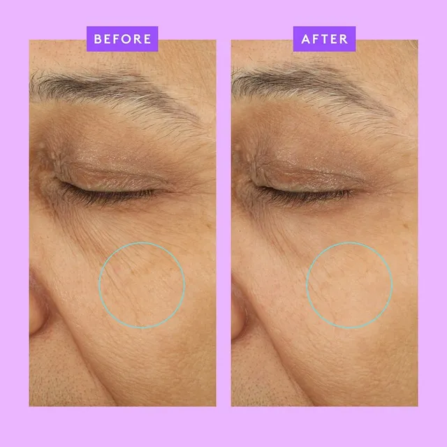 Ceramighty AF Eye Balm – image 3