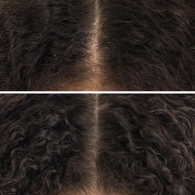 Pre-Shampoo Scalp Cleanser with Probiotic Complex and AHA/BHA – image 2