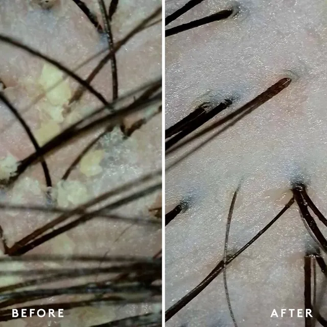 Scalp Remedy Conditioner – image 4