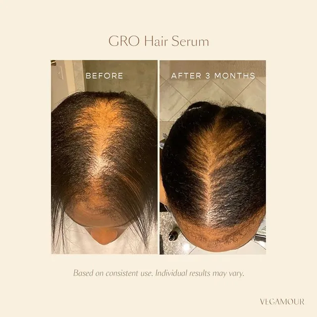 Vegan Cruelty-Free Hair Serum for Thinning Hair - Fast-Absorbing, Non-Greasy Formula – image 4