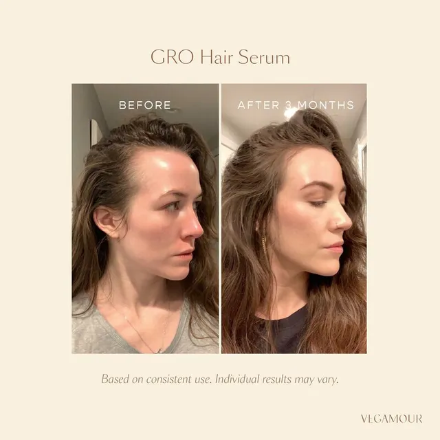 Vegan Cruelty-Free Hair Serum for Thinning Hair - Fast-Absorbing, Non-Greasy Formula – image 5