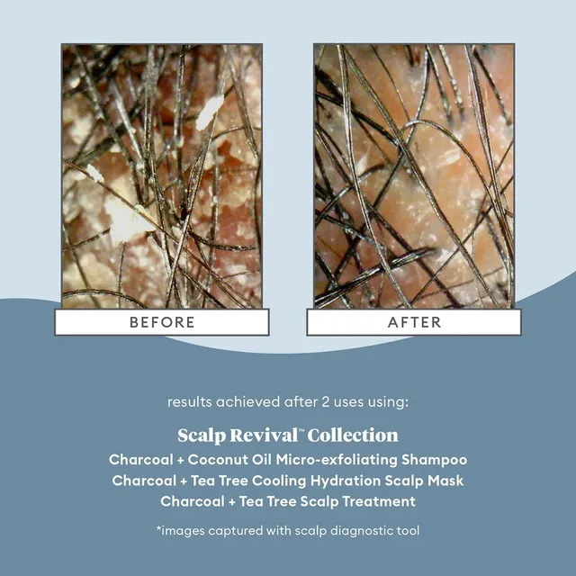 Scalp Revival Charcoal Coconut Oil Exfoliating Shampoo – image 4