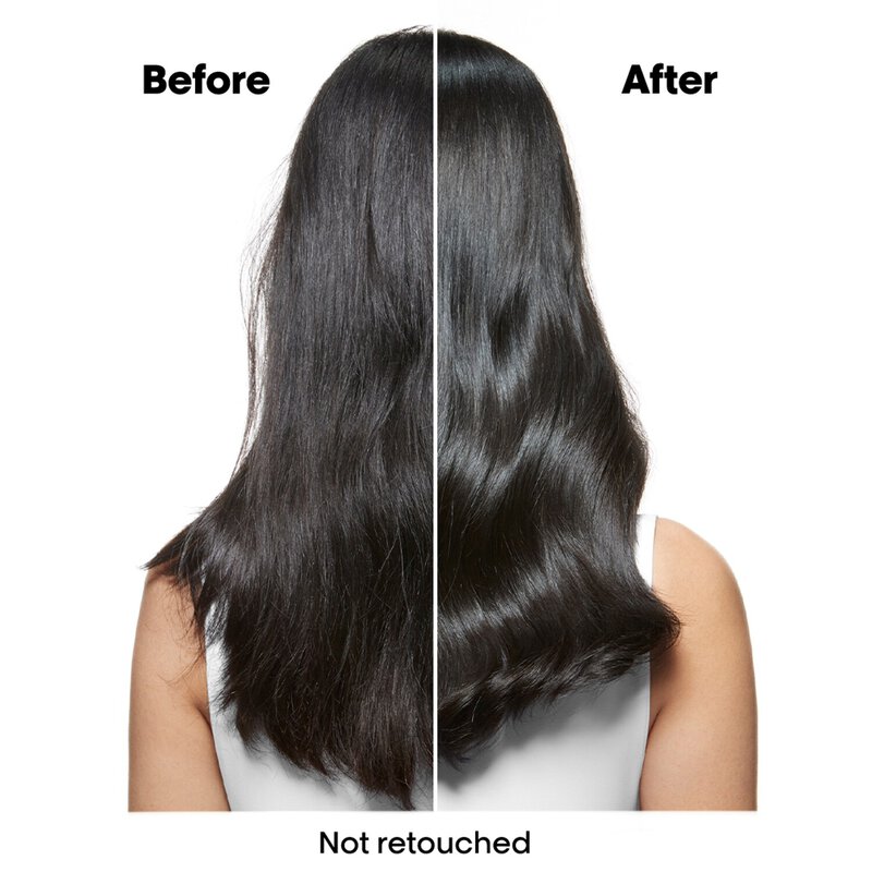 شامبو سكالب أدفانسد ضد القشرة، لفروة الرأس المصابة بالقشرة