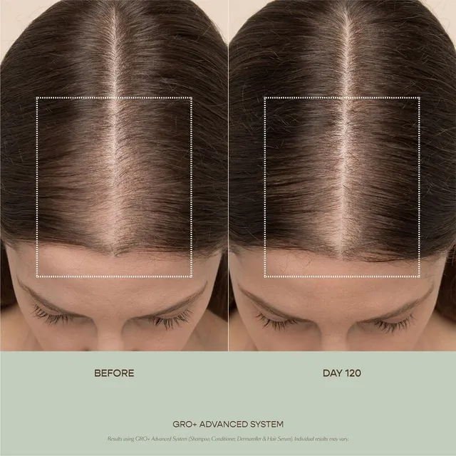 GRO+ Advanced Hair Serum with GROActive+ Complex™ – image 3