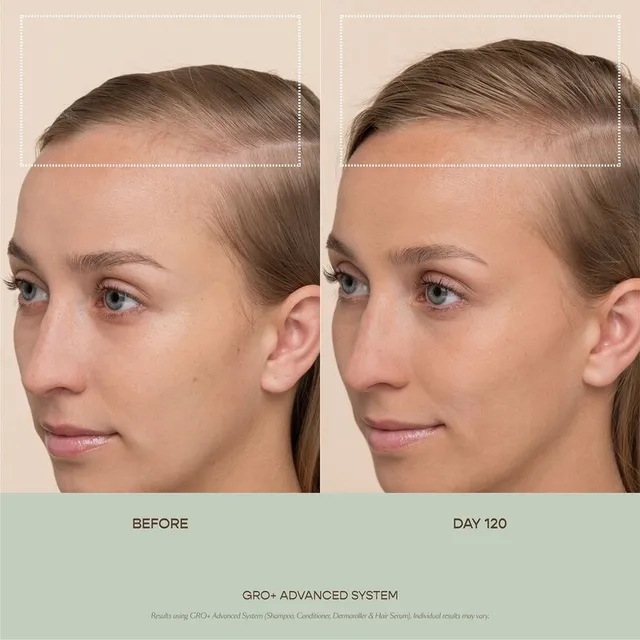 GRO+ Advanced Hair Serum with GROActive+ Complex™ – image 4