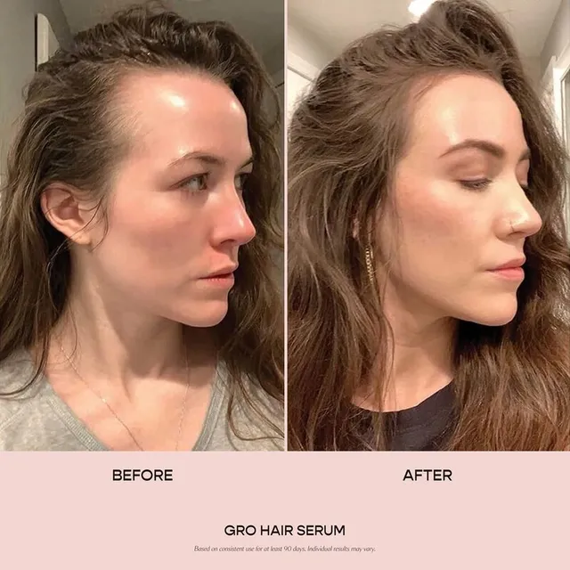 Vegan Scalp Serum with Turmeric, Caffeine, and Plant Blend – image 4
