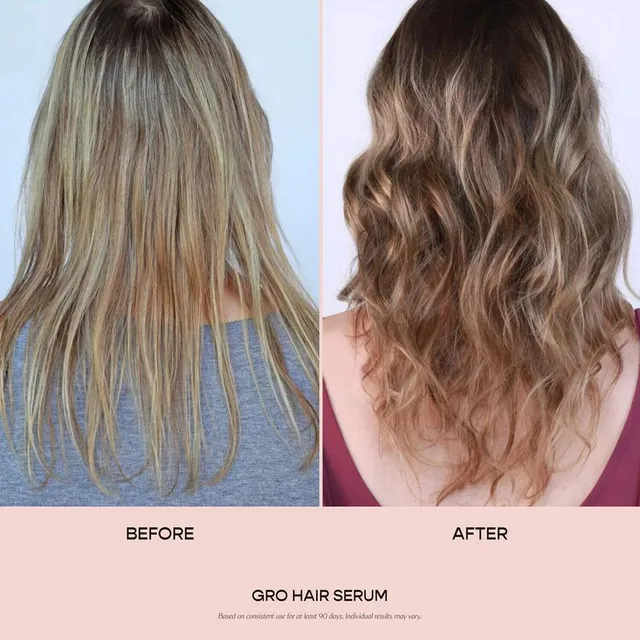 Vegan Scalp Serum with Turmeric, Caffeine, and Plant Blend – image 5