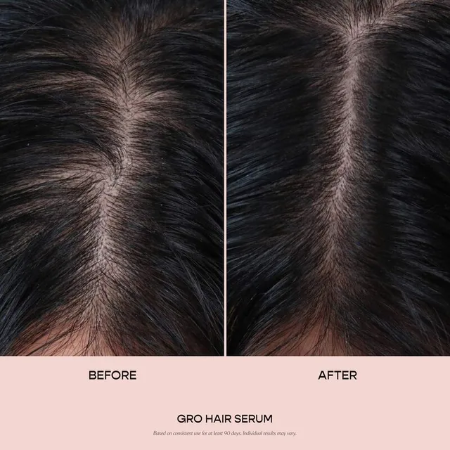 Vegan Scalp Serum with Turmeric, Caffeine, and Plant Blend – image 6