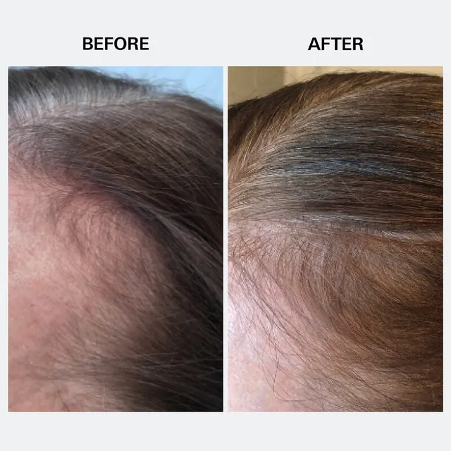 Youth Juice Collagen Scalp Treatment – image 5