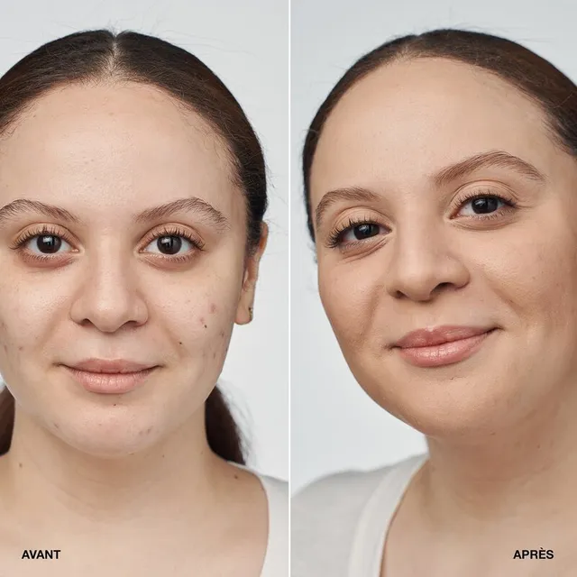 كريم أساس سيروم إيفن بيتر كلينيكال™ مع معامل حماية SPF20 – صورة 4