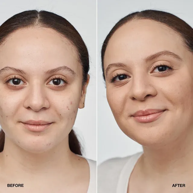 كريم أساس سيروم إيفن بيتر كلينيكال™ مع معامل حماية SPF20 – صورة 5