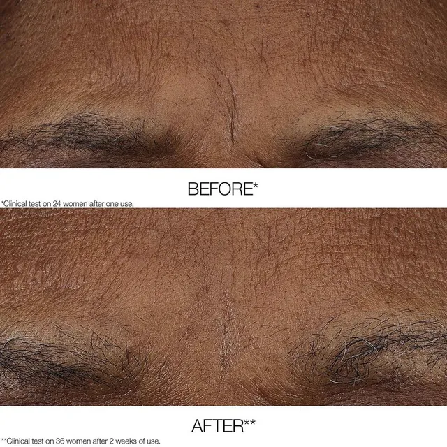 Smart Retinoid Balm – image 4