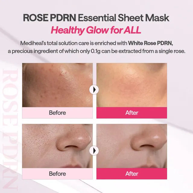 Essential Rose Pdrn Mask Healthy Glow – image 6