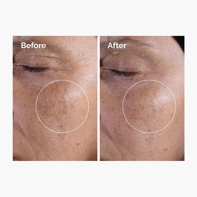 Glycolic Acid 7% Exfoliating Toner – image 4