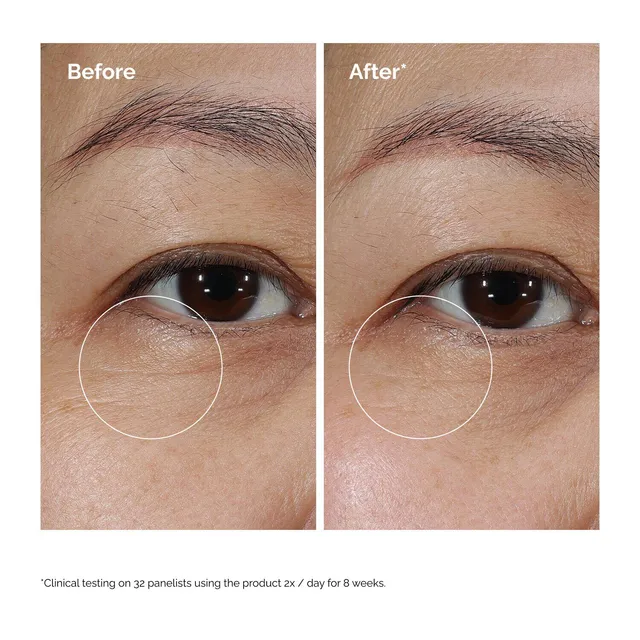 Lacto-PDRN* 4% + B9 Eye Cream – image 6