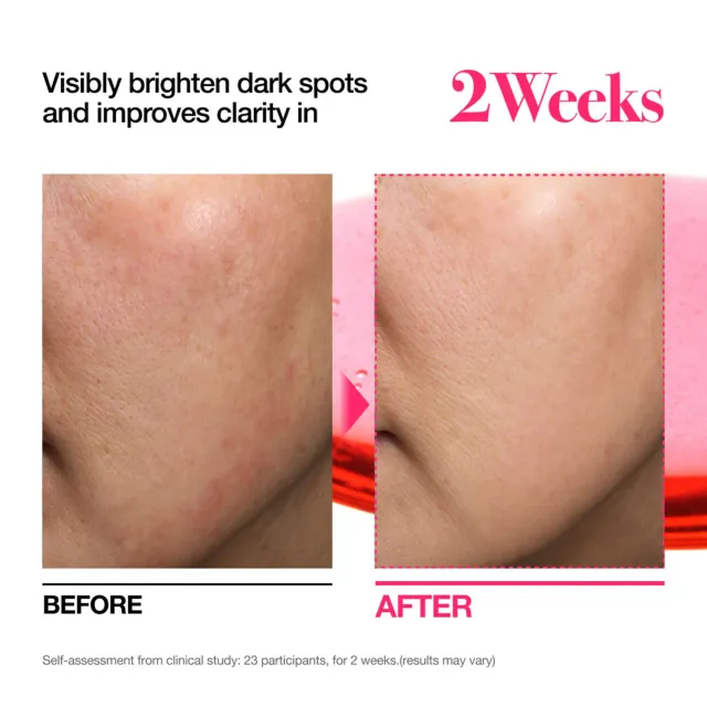 Mini for Dark Spot TXA4 – image 3