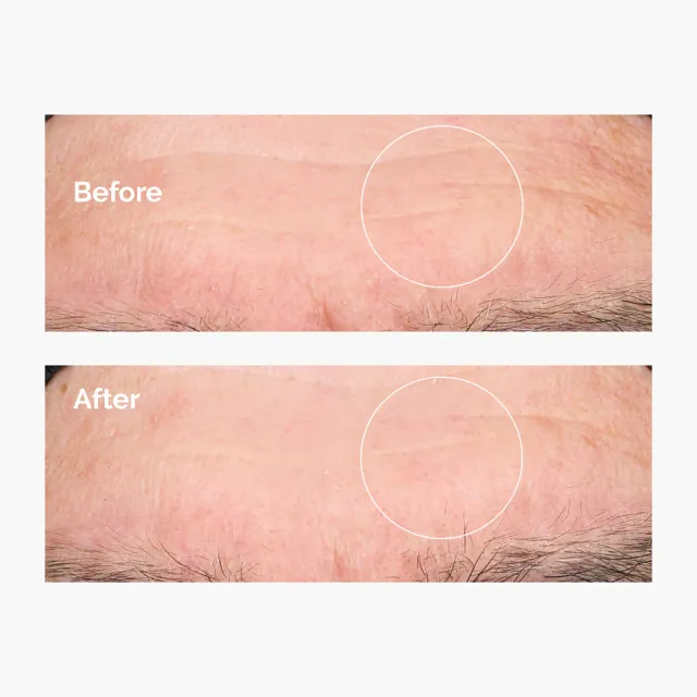 Hyaluronic Acid 2% + B5 – image 4