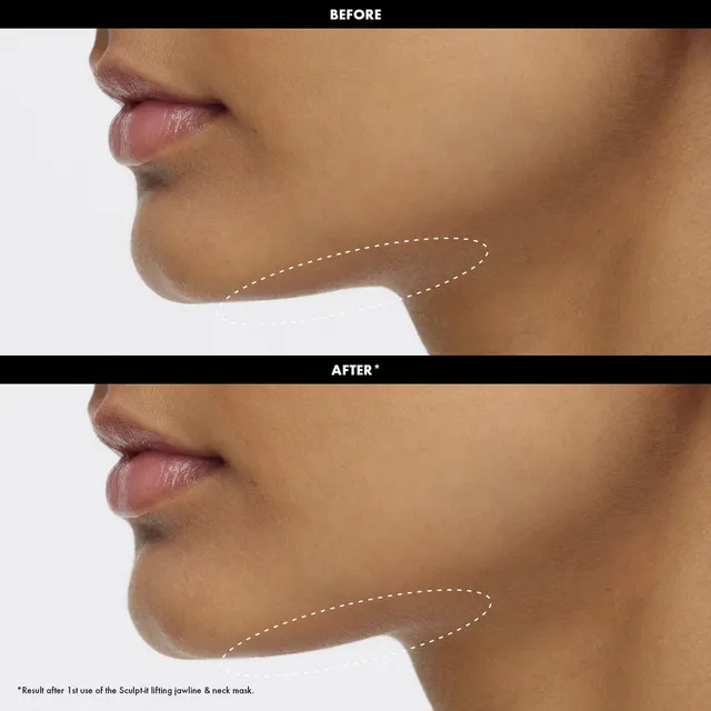 Sculpt-It Mask Lifting-Effect Chin and Neck Mask – image 3
