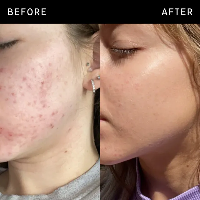 Niacinamide Serum – image 2