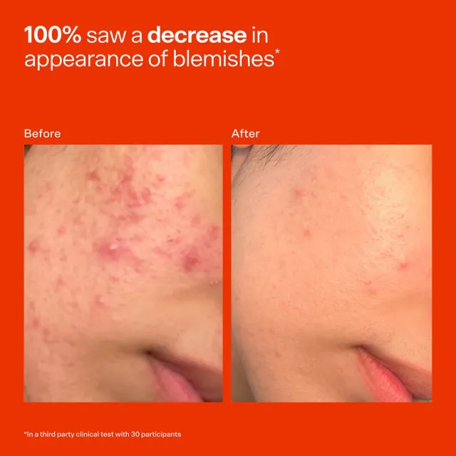Mini SOS Daily Rescue Facial Spray – image 4