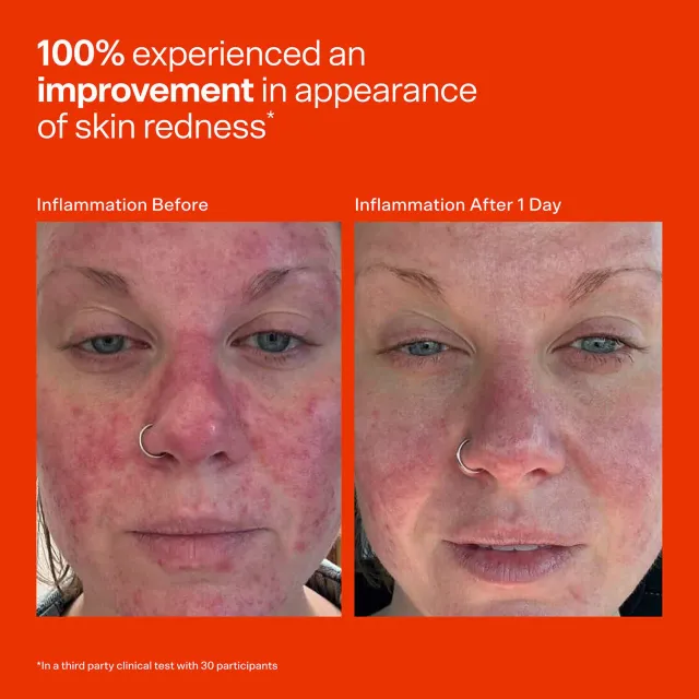Mini SOS Daily Rescue Facial Spray – image 5