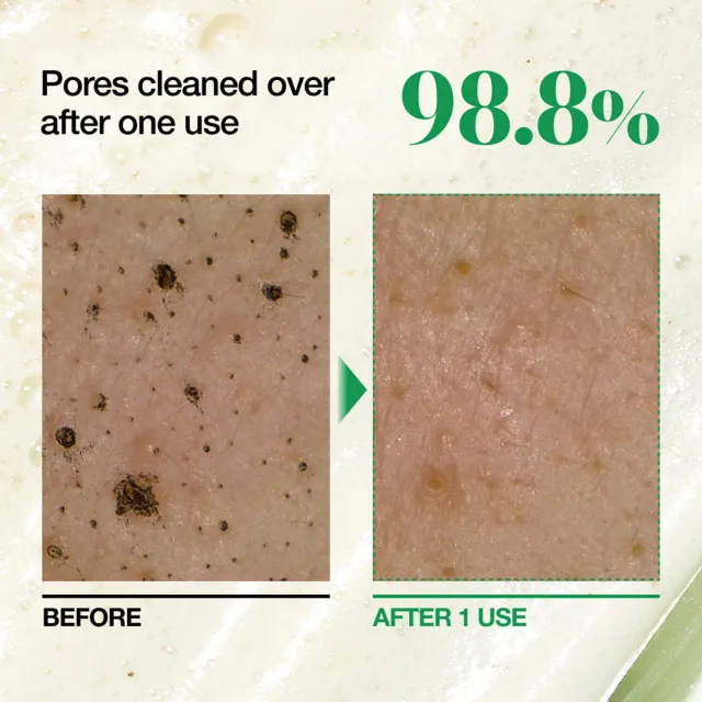 Heartleaf Quercetinol Pore Deep Cleansing Foam – image 7