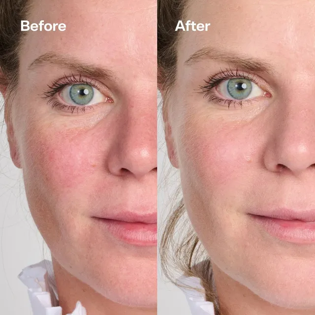 Secret Agent Color Correcting Balm Redness Fix – image 4