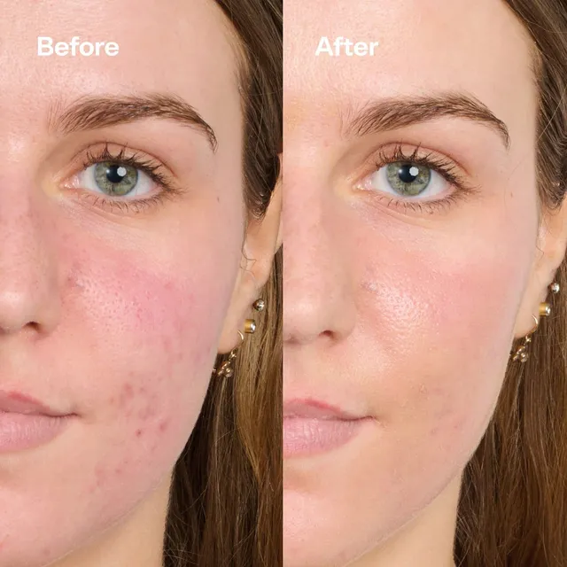 Secret Agent Color Correcting Balm Redness Fix – image 5