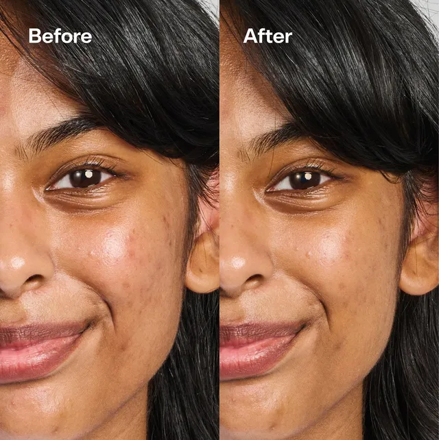 Under Cover Color Correcting Balm Dark Spot Fix – image 4